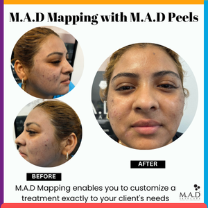 Meet M.A.D MAPPING