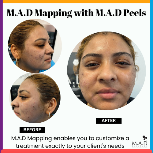 Meet M.A.D MAPPING